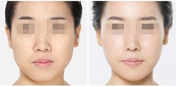 深圳整形美容醫(yī)院排名前十，哪家更受用戶好評？