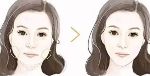 廣州拉皮手術(shù)哪里做效果好？華美、曙光等知名醫(yī)院上榜！
