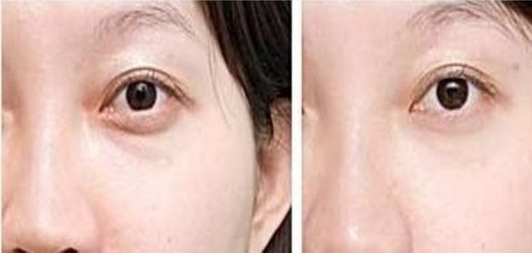 上海排名靠前的整形醫(yī)院推薦，想知道哪家好？最受歡迎的三甲醫(yī)療機(jī)構(gòu)名單已公布！