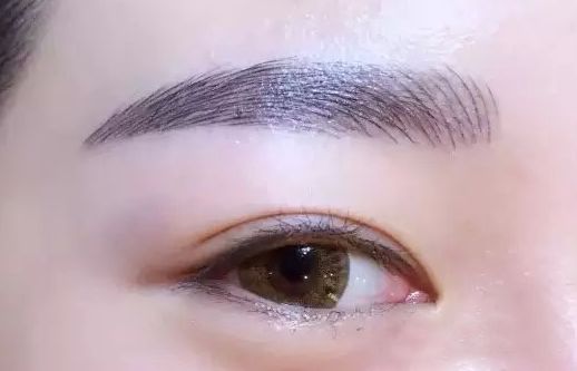 重慶王量醫(yī)生的面部脂肪填充案例一覽 重慶王量醫(yī)生的面部脂肪填充案例一覽