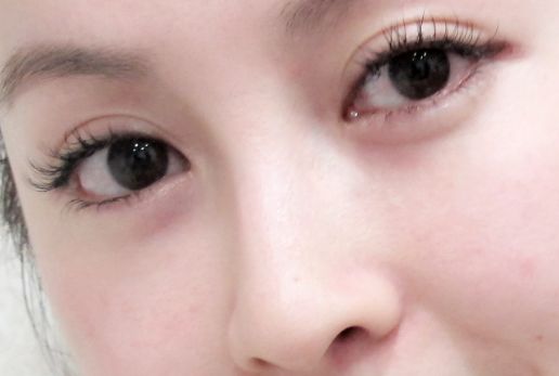 汕頭哪家醫(yī)美機構(gòu)正規(guī)可信呢？