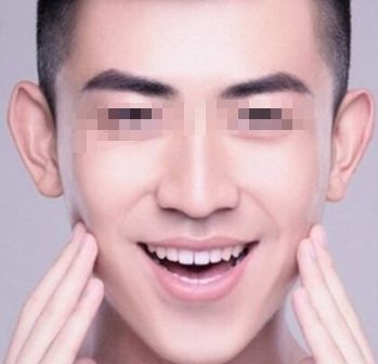 北京治疤痕手術(shù)哪家醫(yī)院好？