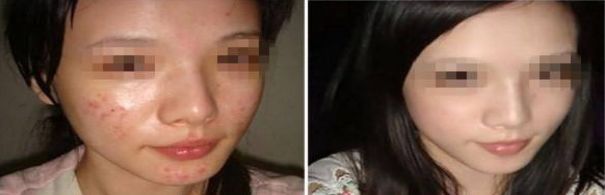 成都整形美容醫(yī)院排名揭曉，領(lǐng)先競爭對手遠遠搶先！