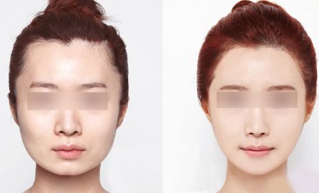 昆明哪里有最好的眼部手術(shù)整形醫(yī)院？2024年10家排名搶先曝光！
