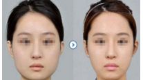 【2024】杭州十大值得信賴的整形美容醫(yī)院推薦！
