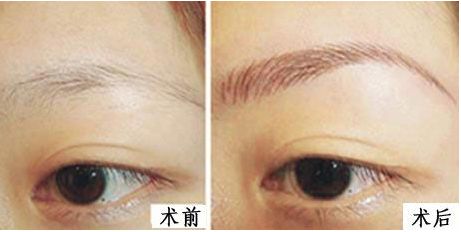 上海九院整形外科醫(yī)生排名新鮮發(fā)布！3位專家各具特長！