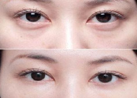 北京最受歡迎的整形醫(yī)院排名高居前三！私立醫(yī)美實(shí)力超越公立醫(yī)院！