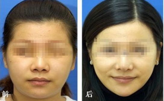 昆明乳房整形哪家醫(yī)院專業(yè)可信？榜單前五推薦，選你中意的
