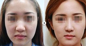 貴陽(yáng)吸脂醫(yī)院口碑排名榜單:整友親測(cè)推薦有保障 貴陽(yáng)吸脂醫(yī)院口碑排名榜單:整友親測(cè)推薦有保障