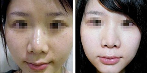 合肥哪幾家三甲整形醫(yī)院受歡迎？