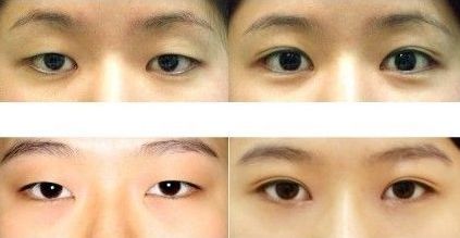 上海眼王醫(yī)生排行榜前五名大咖介紹，助您尋找頂級專家