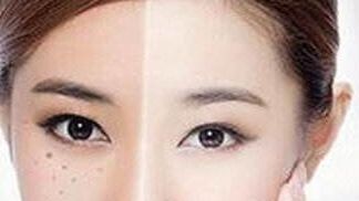 獨(dú)家揭秘！了解重慶楊武林醫(yī)生的墊下巴整形全過程