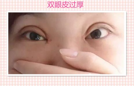汕頭伊麗莎白醫(yī)療美容診所服務(wù)口碑分析，醫(yī)生實力深度解讀__成功案例報道