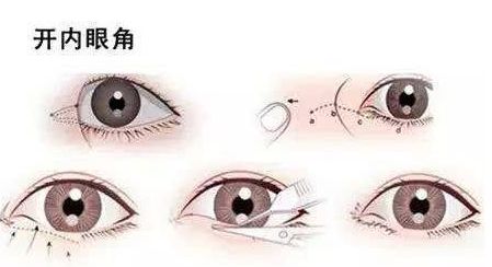 北京哪家專業(yè)醫(yī)院提供高水平的拉皮手術(shù)服務(wù)？權(quán)威機(jī)構(gòu)，口碑一流，高性價比可靠選擇！