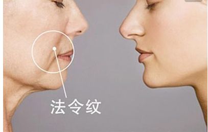 長(zhǎng)沙田毅雙眼皮手術(shù)新穎獨(dú)特，引領(lǐng)2023最新潮流