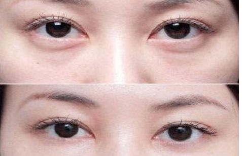 沈陽哪個(gè)醫(yī)院的整形專家口碑好，醫(yī)術(shù)高超的醫(yī)生推薦