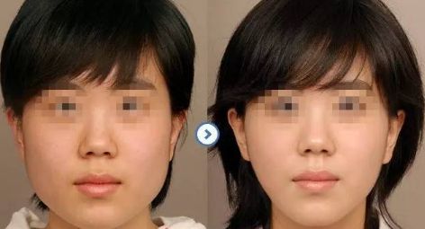 昆明頂尖眼部醫(yī)生一覽:驚人實力的前五位專家名單曝光 昆明頂尖眼部醫(yī)生一覽:驚人實力的前五位專家名單曝光
