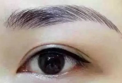 各路醫(yī)生實力大比拼！同帥與楊亞益，誰在雙眼皮手術(shù)上更出彩？