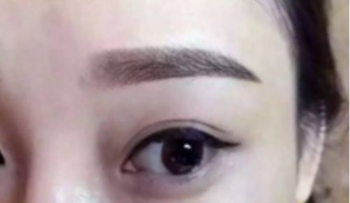 鄭州哪家整形醫(yī)院排名前五，取出異物效果好