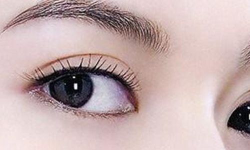 太玲美眸重現(xiàn)！揭秘雙眼皮新趨勢，驚艷效果讓人眼前一亮