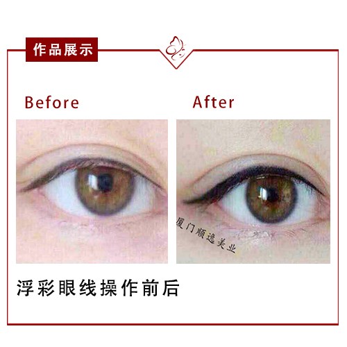 華美整形醫(yī)院在廣州口碑如何？高順福、袁耀東醫(yī)生值得信賴嗎？