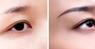 重慶頂尖眼部整形醫(yī)生、醫(yī)院排行榜一覽