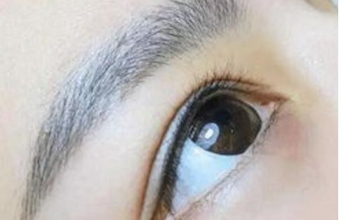 廣州名麗醫(yī)療美容醫(yī)院隆鼻案例分享：真實(shí)口碑大揭秘！