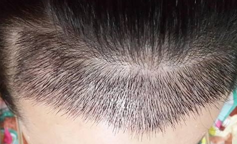 看看這八家贛州整形醫(yī)院有沒有靠譜的？你知道嗎？