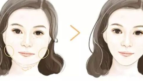 北京哪家整形醫(yī)院的隆鼻效果好？排行榜公開！