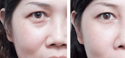 上海治療疤痕的醫(yī)院排名出爐！五家專業(yè)醫(yī)院實力震撼，趕快了解！