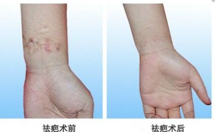 北京自體脂肪隆胸專家真實(shí)排行，專業(yè)技術(shù)精粹一同分享