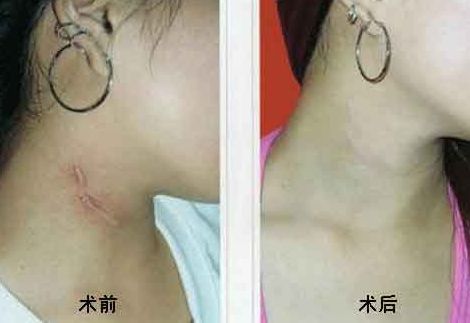 重慶乳房整形六大權(quán)威醫(yī)生盤點(diǎn)，高素質(zhì)專家排行曝光