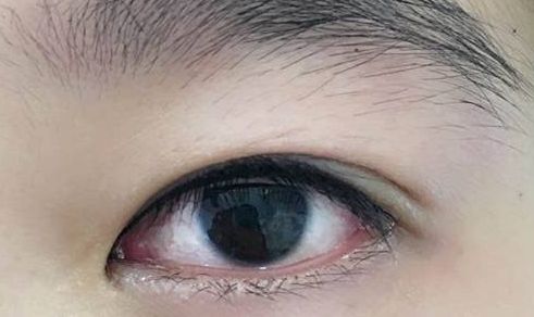 上海整形界最受歡迎的吸脂專家推薦，李耐國、曹衛(wèi)剛、李發(fā)成等醫(yī)生備受贊譽！附真實案例供參考