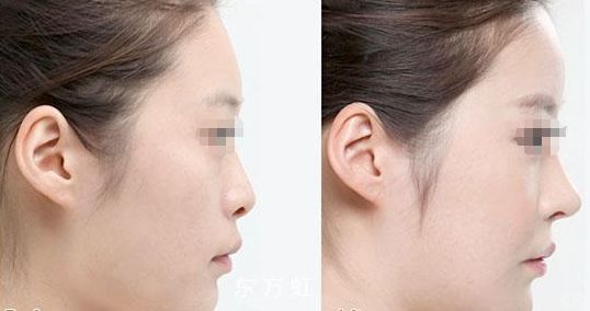 蘇州無線頻率融脂?？漆t(yī)生排名前十這幾位醫(yī)術(shù)聲譽(yù)超卓的醫(yī)生是您的不二之選