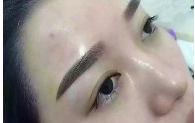 山西二院整形科的醫(yī)生名單更新及熱門項(xiàng)目?jī)r(jià)格表分享 山西二院整形科的醫(yī)生名單更新及熱門項(xiàng)目?jī)r(jià)格表分享