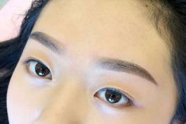 如何優(yōu)雅地擁有雙眼皮？了解專家經(jīng)驗與最新案例！