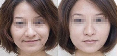 成都有哪些專業(yè)的雙眼皮整形醫(yī)生值得推薦？