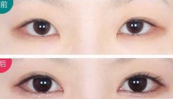 全國頂級(jí)整形醫(yī)院奉上前十年度最佳隆胸選擇！專業(yè)可靠服務(wù)，平價(jià)優(yōu)惠！
