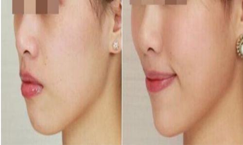 北京最強雙眼皮醫(yī)院推薦，安貞、美萊、八大處霸主爭鋒！