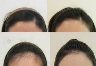 上海久愿整形醫(yī)院:醫(yī)術高超的專家團隊及服務費用展示 上海久愿整形醫(yī)院:醫(yī)術高超的專家團隊及服務費用展示