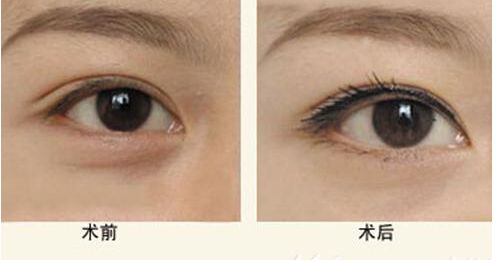 【獨家】上海九院整形科醫(yī)生王琛醫(yī)生的專長與案例分享 【獨家】上海九院整形科醫(yī)生王琛醫(yī)生的專長與案例分享