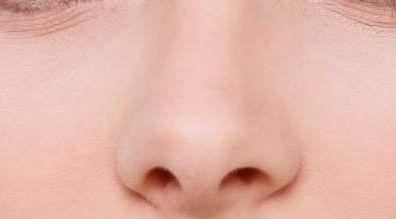 泉州哪家醫(yī)院在脂肪填充整形領域有口碑？重新認識久負盛名的歐菲整形