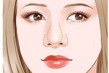 濟(jì)南哪家醫(yī)生做雙眼皮效果好？謝燕燕醫(yī)生實(shí)力及案例揭秘！