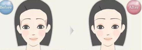 揭密石家莊哪位雙眼皮醫(yī)生備受關(guān)注，優(yōu)點(diǎn)揭秘，價格參考！