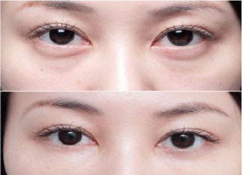 武漢隆胸手術(shù)醫(yī)院2023整友力打造推薦推薦 武漢隆胸手術(shù)醫(yī)院2023整友力打造推薦推薦