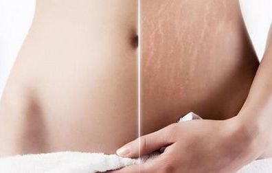 浙江知名隆胸醫(yī)院推薦！這些醫(yī)院廣受好評