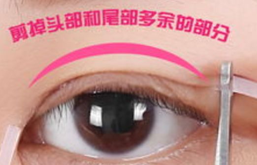 樂山市人民醫(yī)院眼袋手術(shù)口碑如何？醫(yī)生推薦+真實案例分析