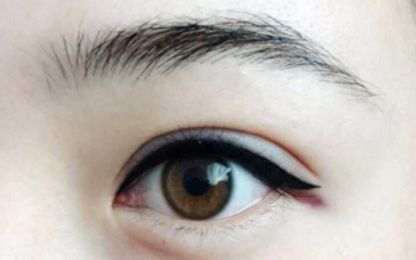 南寧醫(yī)科大雙眼皮整形費用及技術(shù)綜述！名單與收費指南分享