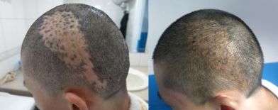 上海治療斑點好的醫(yī)院有哪些？伊萊美、仁愛、薇琳等都備受認可！