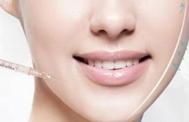 鄭州哪家醫(yī)院割雙眼皮效果好？推薦二附院、華領(lǐng)等夏城里的醫(yī)院！